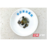 女子患结石却因工作忙而迟迟未治疗 如今胆囊险被结石塞满