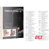 《图解腔镜甲状腺手术》发行 湖南省肿瘤医院助推腔镜技术与甲状腺外科新发展