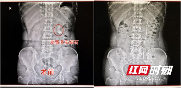 图片3.wm.jpg