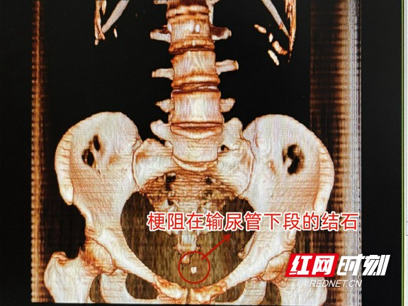 图片1.wm.jpg