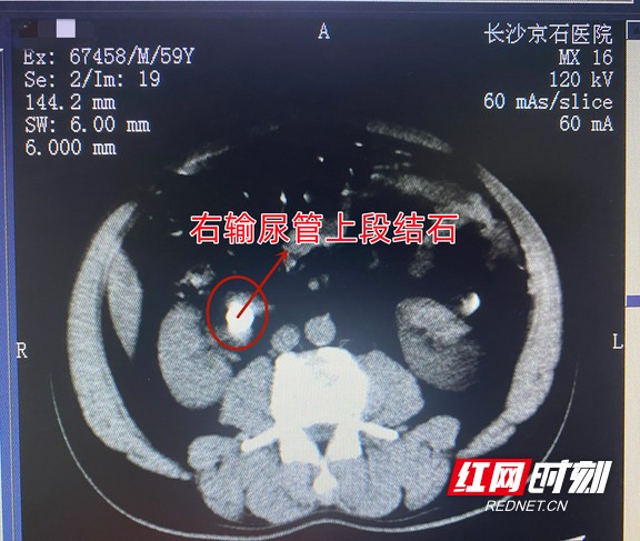 图片3.wm.jpg