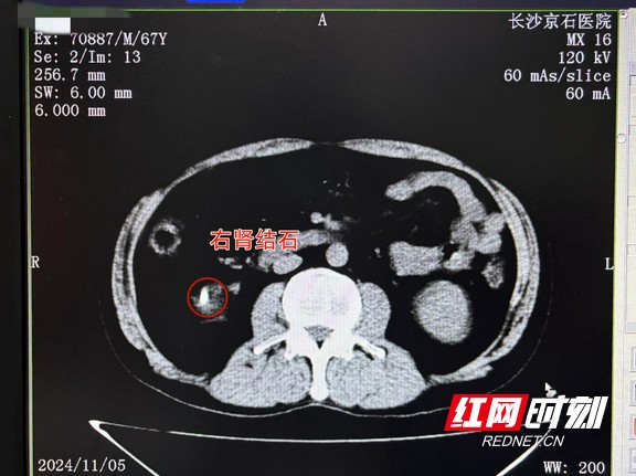 图片1.wm.jpg