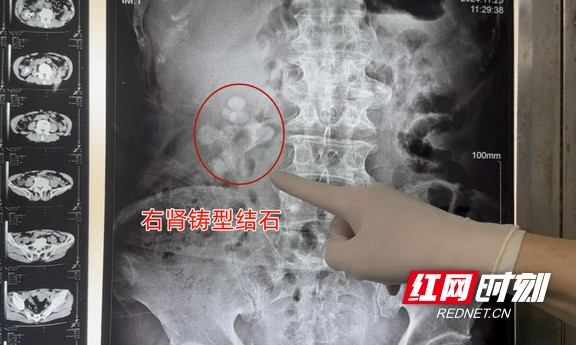 图片3.wm.jpg