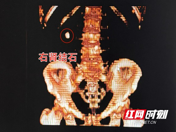 图片1.wm.jpg