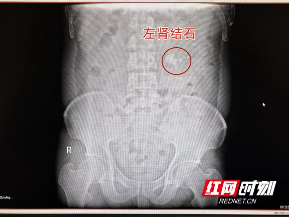 图片4.wm.jpg