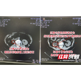 女子右腰偶有胀痛误以为劳累所致 不料真凶竟是颗黄豆大结石