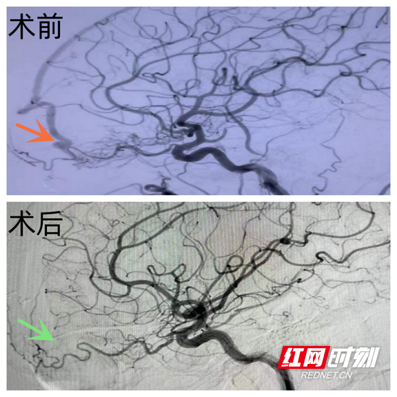 图片2.marked.png