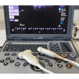 关爱心脏：从一次无创超声检查开始