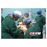 中南雅康医院成功摘除困扰患者20年的巨大肿瘤