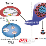 湘雅医院：揭示新型抑制剂治疗黑素瘤有效的核心机制
