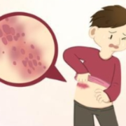 带状疱疹为何在冬季容易高发？如何预防？