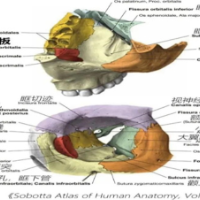 “水汪汪”的突眼在狂跳？脑脊液眶漏遇上颈动脉瘘的求救信号!
