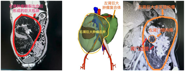湘雅二医院1.png