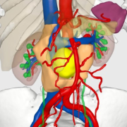 勇闯手术“禁区” 中南大学湘雅医院泌尿外科精准切除腹膜后复杂肿瘤