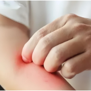 又到飞絮季!这份过敏预防指南,快查收