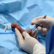 为500克超早产儿打通“生命通道”，湘雅医院成功实施高难度PICC置管术