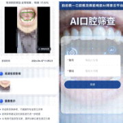 湘雅医院开发口腔健康AI筛查工具,口腔癌可实现“一图自查”