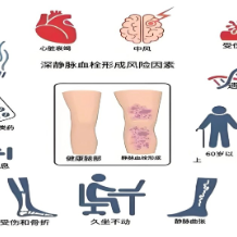 世界血栓日 | 血栓不是“梗”,预防才是关键