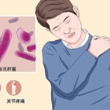 发烧腰痛别大意!非牧区居民接连确诊布鲁氏菌病