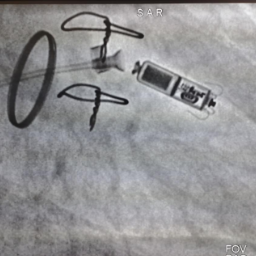 娄底市第二人民医院完成首例无导线心脏起搏器植入术