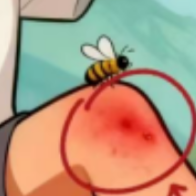 秋游遇“蜂”暴?记住这三步,从“蜇”慌到“镇”定!