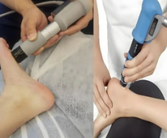 跟腱炎折磨数月!72岁老人靠冲击波疗法重获“无痛行走”