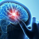 冬季脑卒中高发 有些致病风险你意想不到