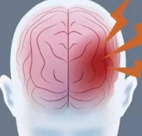 冬季脑卒中高发 有些致病风险你意想不到