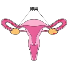 试管婴儿路上的“甜蜜”负担:认识卵巢过度刺激综合征