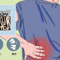“痛到骨头里”?李奶奶反复治不好的痛,竟是骨质疏松在“报警”