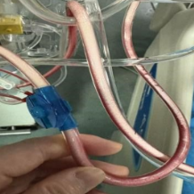 降温就想吃点好的?红烧肘子让小伙住进了ICU