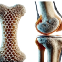 防治骨质疏松，做好这几点