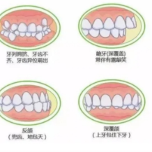 健康科普 | 父母牙齿不齐真的会遗传给孩子吗？