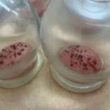 越抓越痒？中医助您安然无“痒”