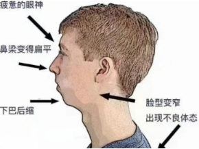 专家揭秘影响孩子面部发育的4大口腔问题