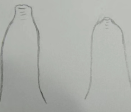 包皮割还是不割？医生这样建议