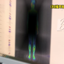 视频 | 告别瞎养生！红外检测告诉你该吃啥、该补啥