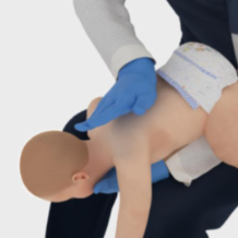 噎住窒息怎么办？别光“顶肚子” 新急救步骤速学