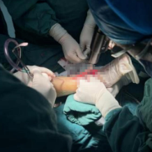 长沙市中医医院首例3D打印导板全踝关节置换术成功开展