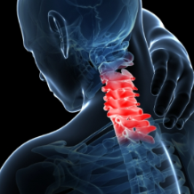 脖子“咔咔”响？医生教你给颈椎“松绑”