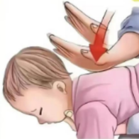 海姆立克急救法2.0版新在哪儿