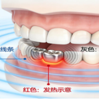 健康科普 | 佩戴假牙和体内有钢板能做磁共振吗?