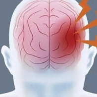 头晕手麻不是小事 警惕“沉默的杀手”