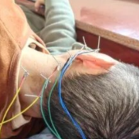 针灸居然还能治疗“耳背”？六旬大哥：“好使！”