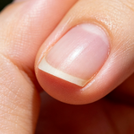 健康科普 | 指甲上的小月牙，真是肝脏的“健康晴雨表”吗？