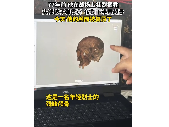 马迹塘无名烈士颅面复原  77年后终于看清他年轻的模样
