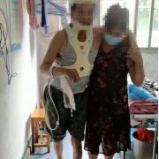 双峰县人民医院十四病室用ACAF手术治疗脊髓型颈椎病