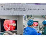 29岁青年确诊肺癌引关注 专家提醒癌症防治需“早”字当头