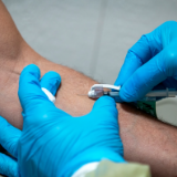 美媒：美国非裔猴痘发病率大幅高于白人 若情况持续或使美国应对工作失效