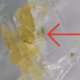 把使用过的口罩放大1000倍，才发现…